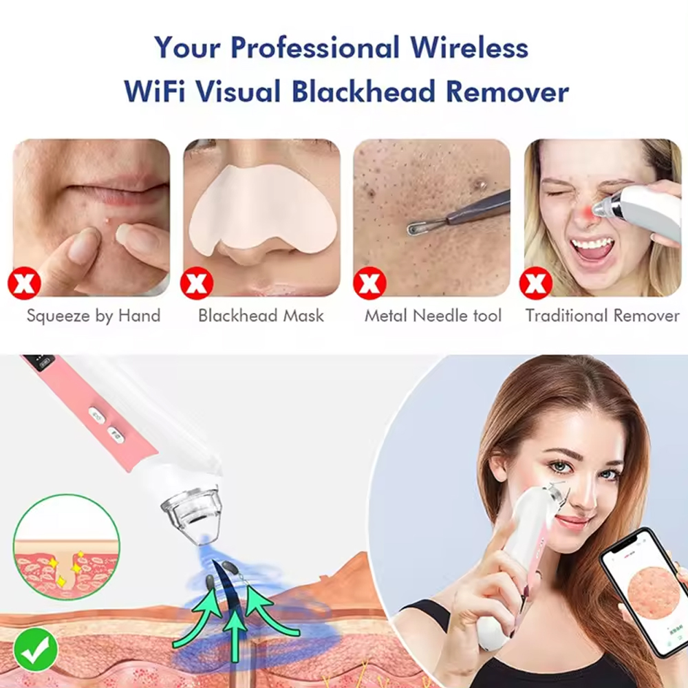 6 Heads Pore Cleaner Blackhead - Nasal Aspirator 评论和价格